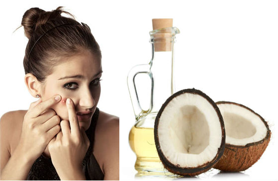 ulei de cocos pentru ten acneic